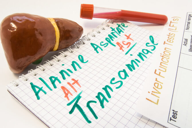 Alanine Aminotransferase