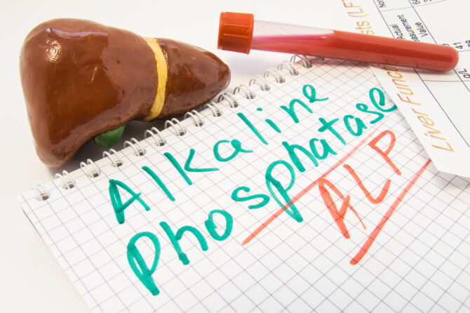 Alkalische Fosfatase