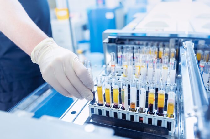 Bijkomende Laboratoriumanalyses bij Afwijkende Bloedstalen