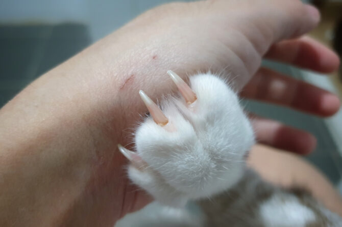 Kattenkrabziekte