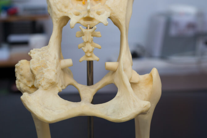 Voedingssupplementen bij artritis